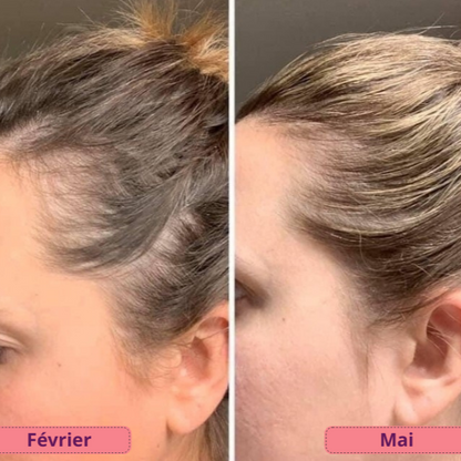 VitalHair Pro |  Massage Cuir Chevelu