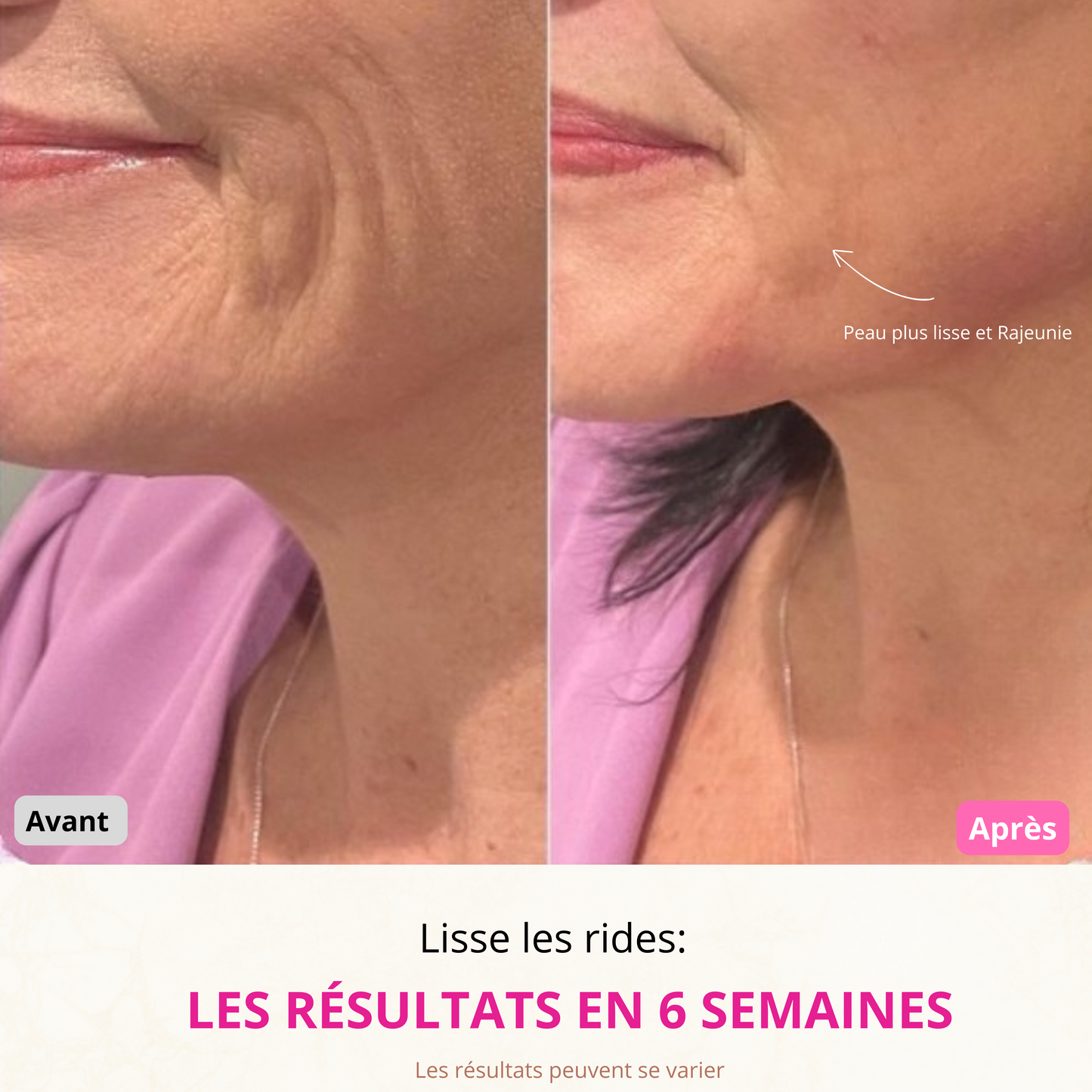 VitaLift Pro | Appareil Liftant Visage + Sérum Anua Offert