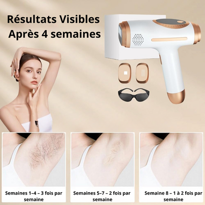 InfiniteSilk™ – Le laser d’épilation intelligent à domicile