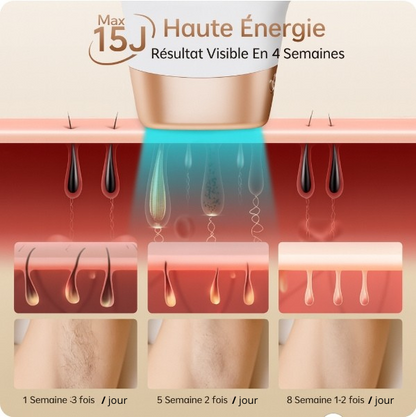 InfiniteSilk™ – Le laser d’épilation intelligent à domicile